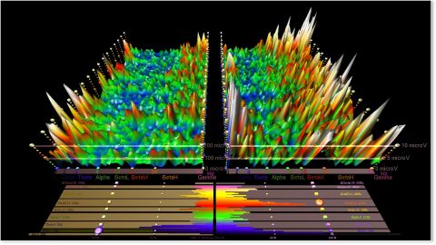 Hipnoterapi-otak-sadar